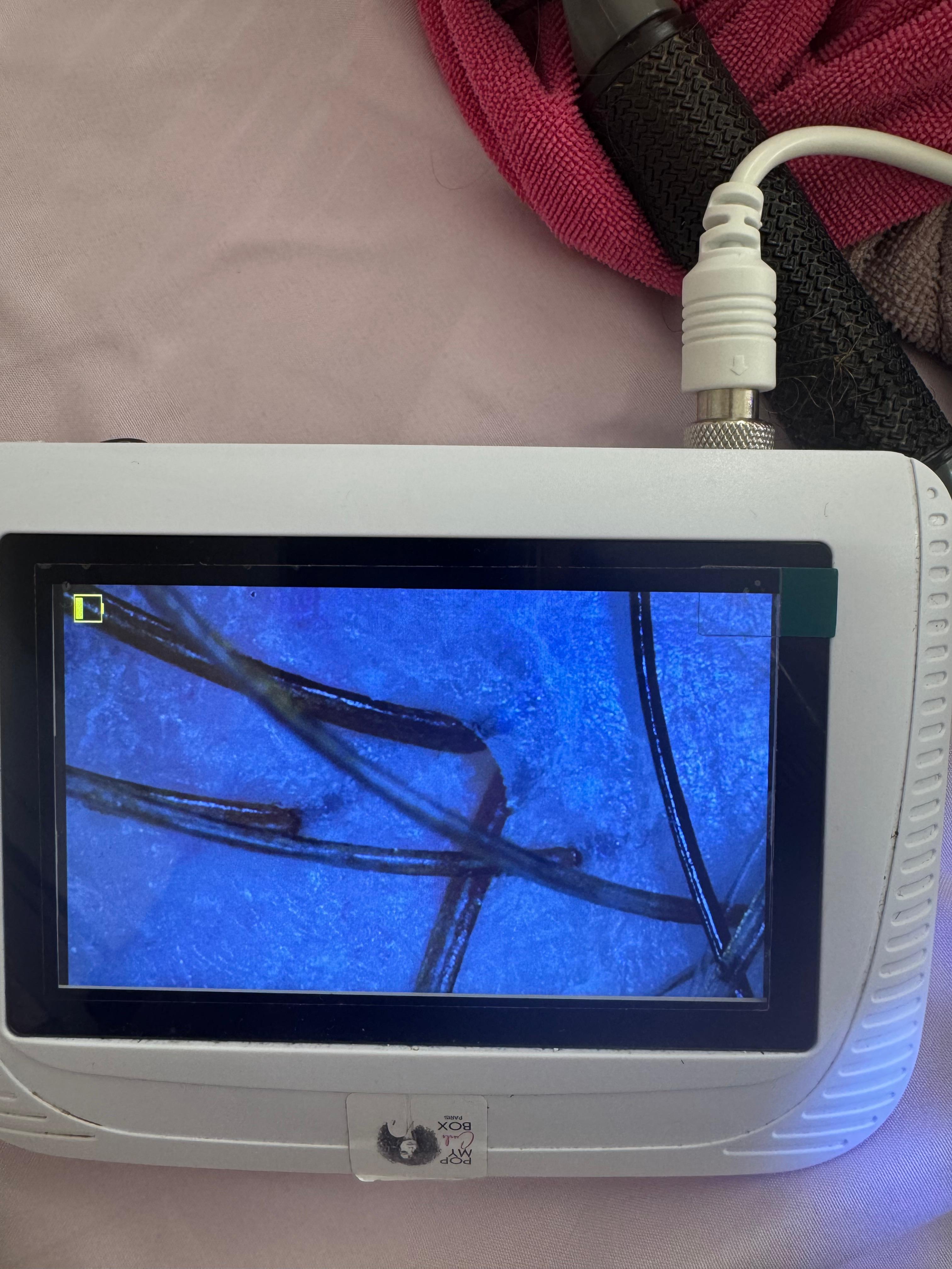 Apr&egrave;s &mdash; cuir chevelu d&eacute;toxifi&eacute;