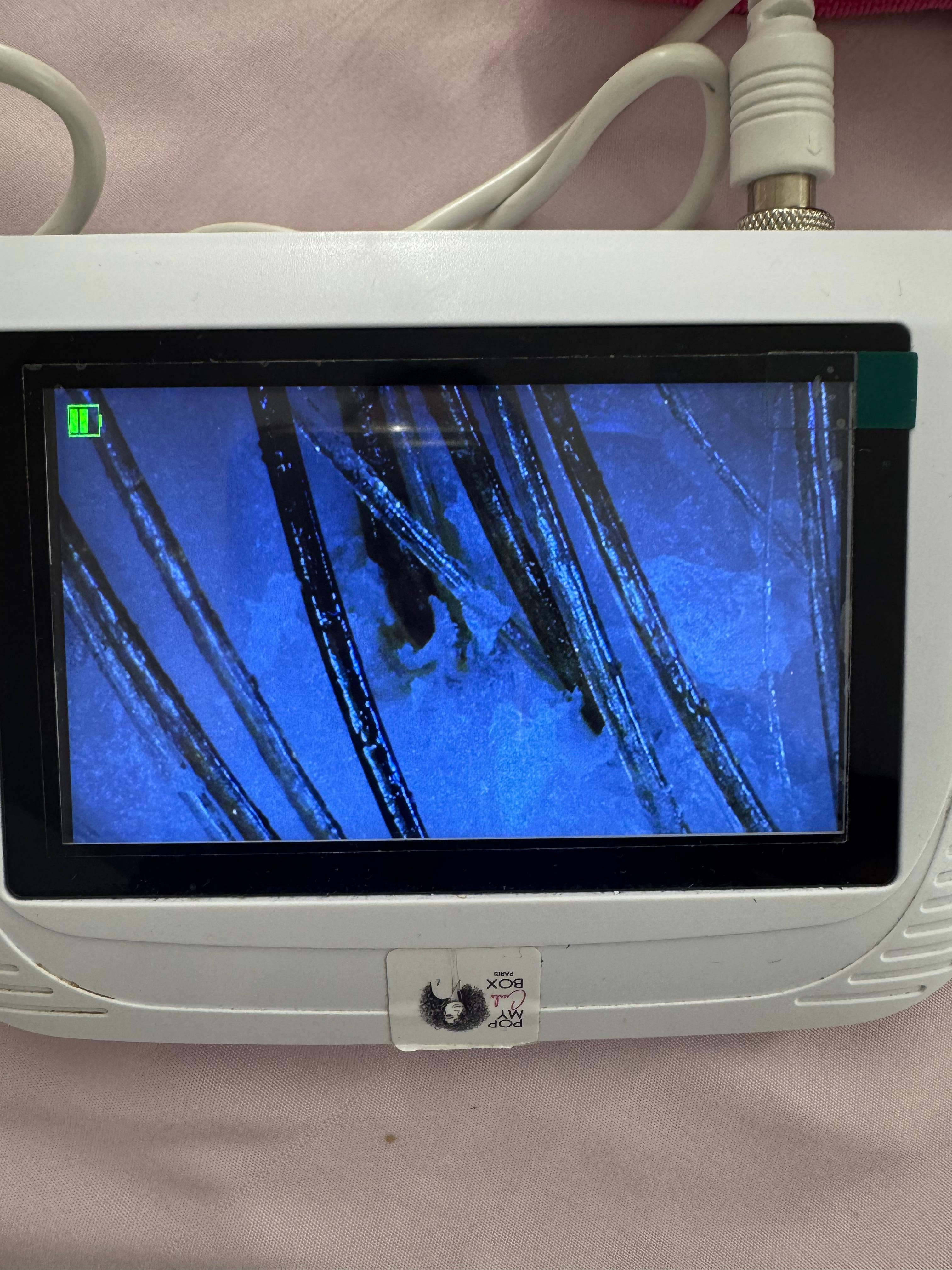 Avant &mdash; cuir chevelu avec impuret&eacute;s